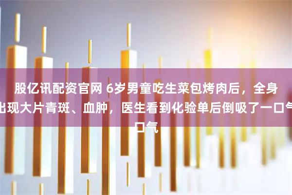 股亿讯配资官网 6岁男童吃生菜包烤肉后，全身出现大片青斑、血肿，医生看到化验单后倒吸了一口气